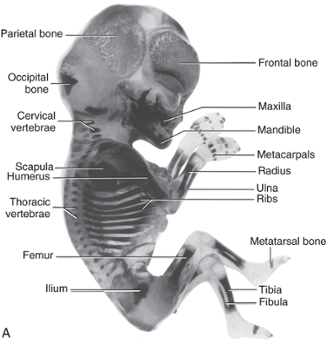 alzarin-stained human fetus 12 weeks