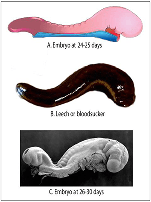 Surely the Qur’anic ‘Alaqah (the embryo during the leech-like stage) is easily observed with the naked&nbsp;eye?