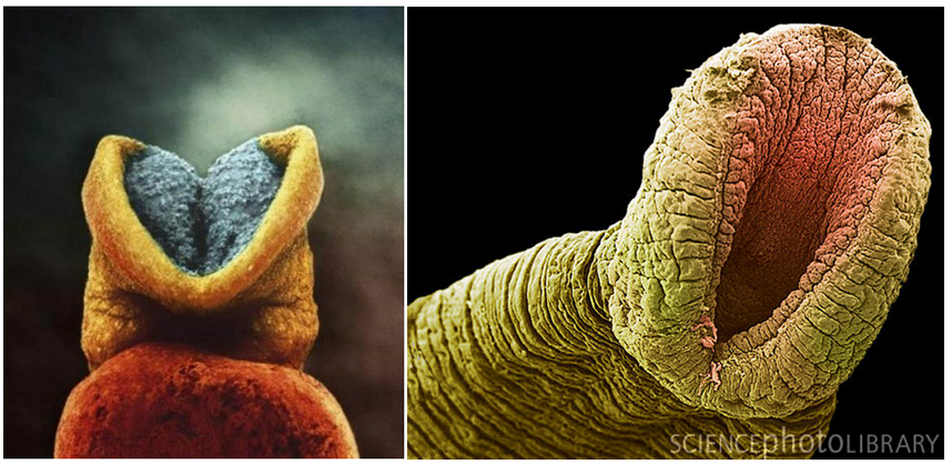 Does this photo of an embryo resemble a leech?