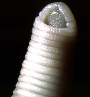 Leech head showing sucker