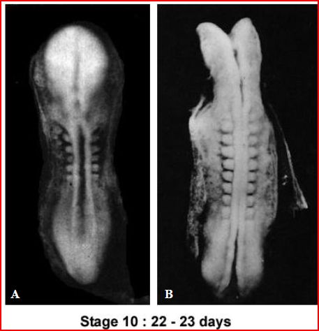 Figure 2: Carnegie Stage 10