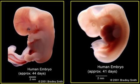 Human embryo human 41 and 44 days