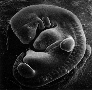 Photograph of an embryo around 28 days