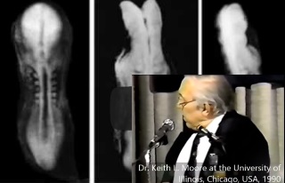 Dr. Keith L. Moore describes the Mudghah stage of human&nbsp;development