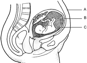 Figure 3. A 20-week fetus in the uterus, surrounded by 'three veils of darkness': (A) abdominal wall; (B) uterine wall; (C) amniochorionic membrane (from Moore, K.L., The Developing Human. Clinically Oriented Embryology, 3rd edn, 1982. W.B. Saunders Co., Philadelphia).