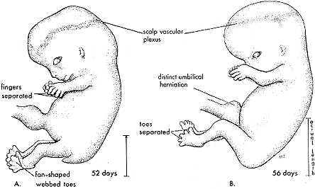Figure 7. Embryos during the eighth week are assuming distinct human characteristics. B, CR 30mm. (from Moore, K.L., The Developing Human. Clinically Oriented Embryology, 3rd edn, 1982. W.B. Saunders Co., Philadelphia). 